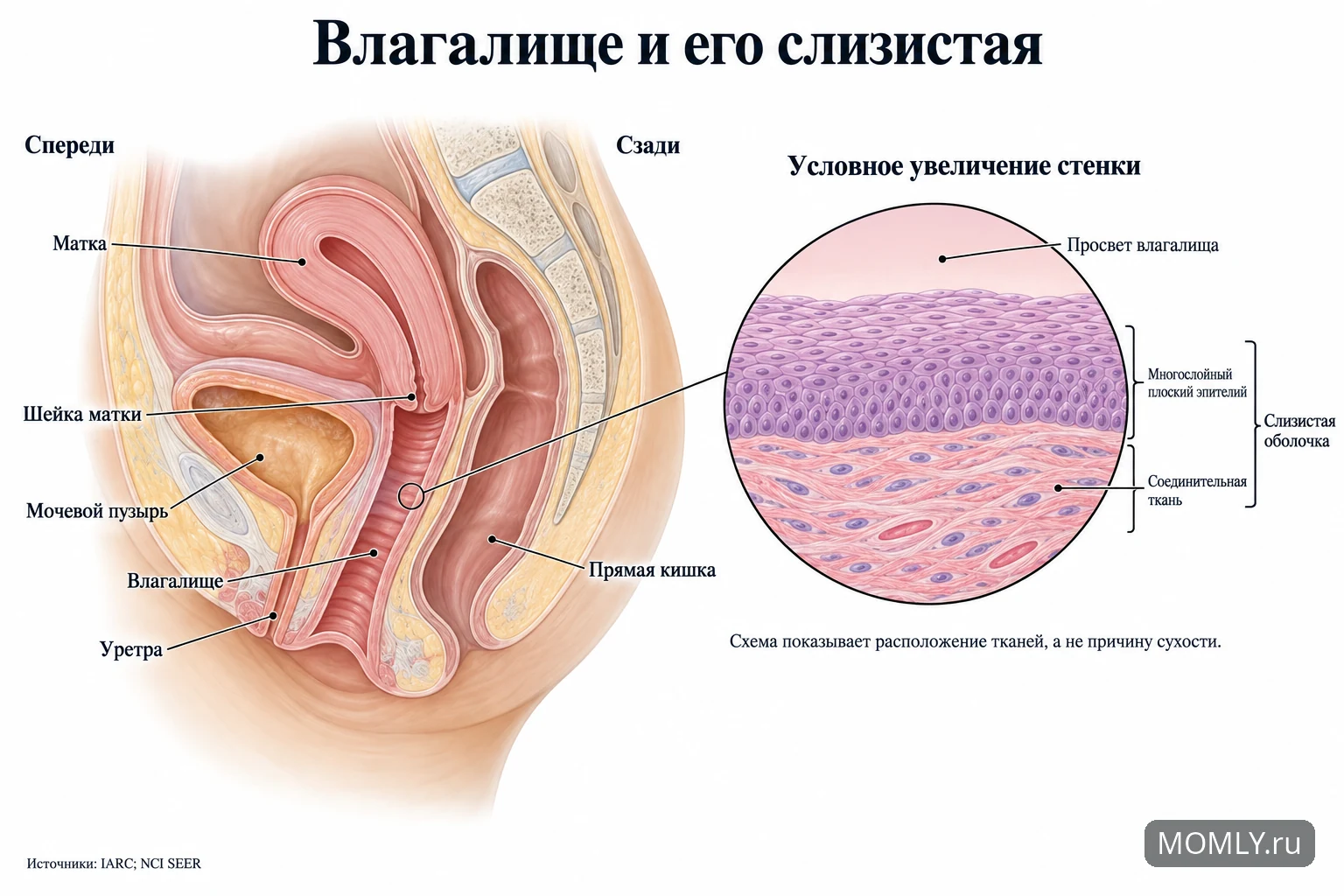 Расположение влагалища между мочевым пузырём и прямой кишкой; условное увеличение слизистой с многослойным плоским эпителием и соединительной тканью.